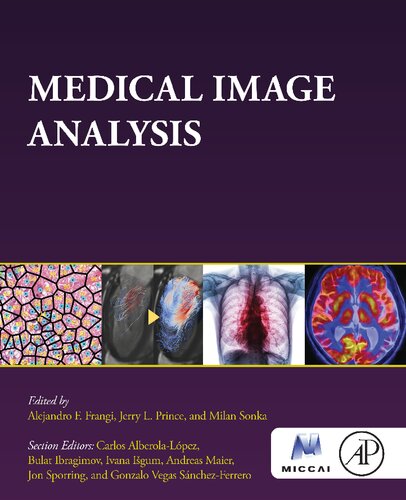 Medical Image Analysis (PDF/EPUB Version)