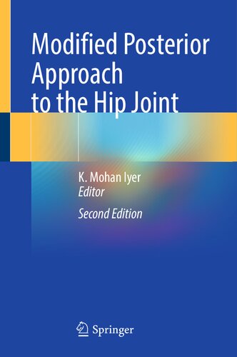 Modified Posterior Approach to the Hip Joint (PDF/EPUB Version)
