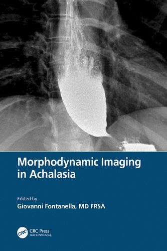 Morphodynamic Imaging in Achalasia (PDF/EPUB Version)
