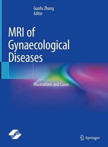 MRI of Gynaecological Diseases: Illustrations and Cases (PDF/EPUB Version)
