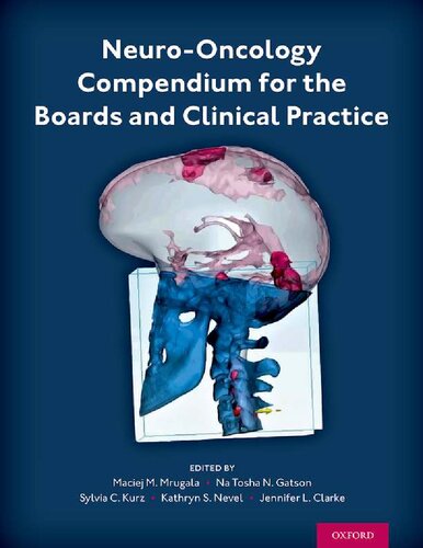 Neuro-Oncology Compendium for the Boards and Clinical Practice [Team-IRA] (True PDF) (PDF/EPUB Version)
