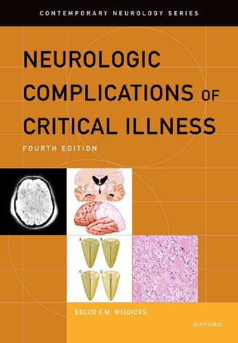 Neurologic Complications of Critical Illness (CONTEMPORARY NEUROLOGY SERIES) [Team-IRA] (PDF/EPUB Version)
