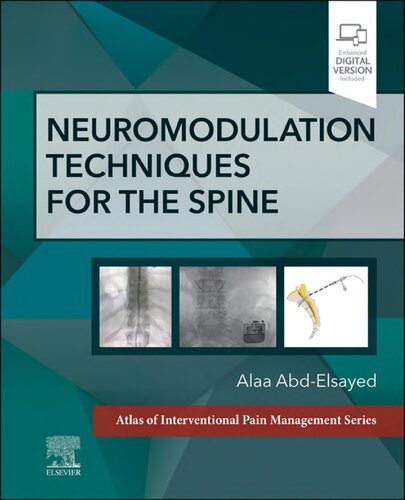 Neuromodulation Techniques for the Spine - E-Book: A Volume in the Atlas of Interventional Pain Management Series (PDF/EPUB Version)
