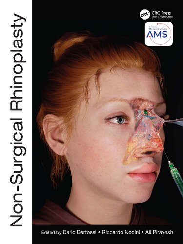 Non-Surgical Rhinoplasty, Riccardo Nocini, Ali Pirayesh (PDF/EPUB Version)
