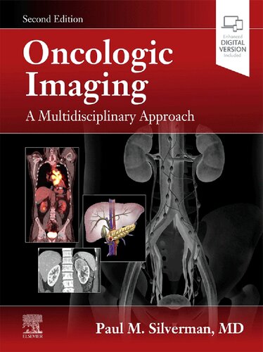 Oncologic Imaging: A Multidisciplinary Approach (PDF/EPUB Version)
