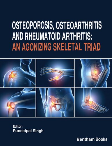 Osteoporosis, Osteoarthritis and Rheumatoid Arthritis - An Agonizing Skeletal Triad (Nov 7, 2023)_(981519609X)_(Bentham Science Publishers) (PDF/EPUB Version)
