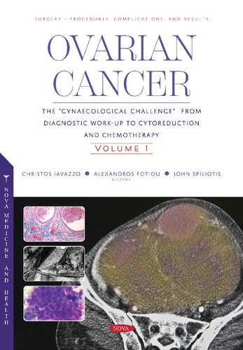 Ovarian Cancer: The “Gynaecological Challenge” from Diagnostic Work-Up to Cytoreduction and Chemotherapy (PDF/EPUB Version)

