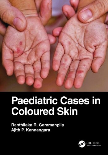 Paediatric Cases in Coloured Skin (PDF/EPUB Version)