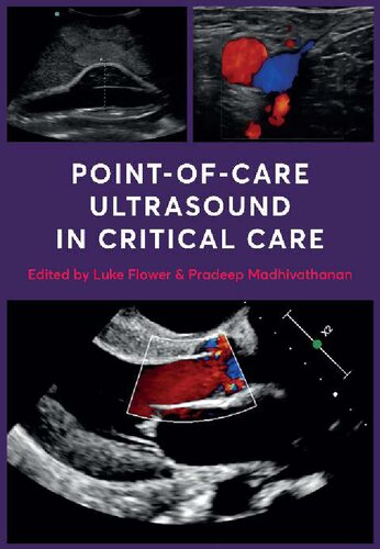 Point-of-Care Ultrasound in Critical Care [Team-IRA] (PDF/EPUB Version)
