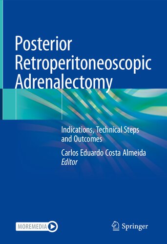 Posterior Retroperitoneoscopic Adrenalectomy: Indications, Technical Steps and Outcomes (PDF/EPUB Version)
