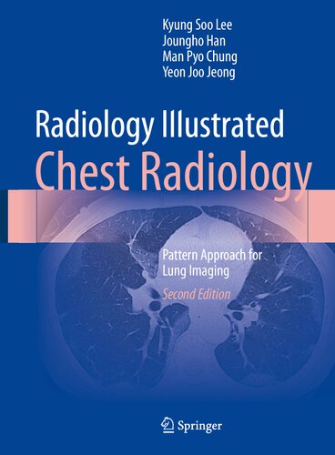 Radiology Illustrated: Chest Radiology: Pattern Approach for Lung Imaging (PDF/EPUB Version)