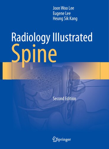 Radiology Illustrated: Spine (PDF/EPUB Version)
