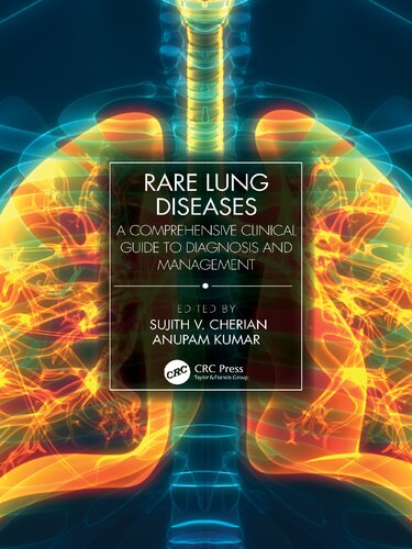 Rare Lung Diseases: A Comprehensive Clinical Guide to Diagnosis and Management (PDF/EPUB Version)
