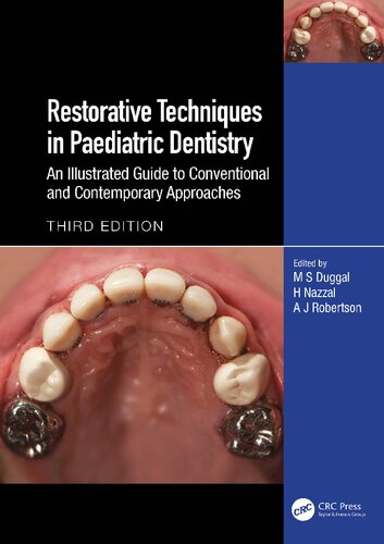 Restorative Techniques in Paediatric Dentistry: An Illustrated Guide to Conventional and Contemporary Approaches (PDF/EPUB Version)