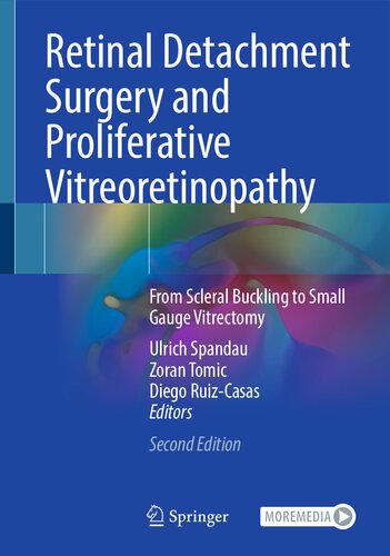 Retinal Detachment Surgery and Proliferative Vitreoretinopathy: From Scleral Buckling to Small Gauge Vitrectomy (PDF/EPUB Version)
