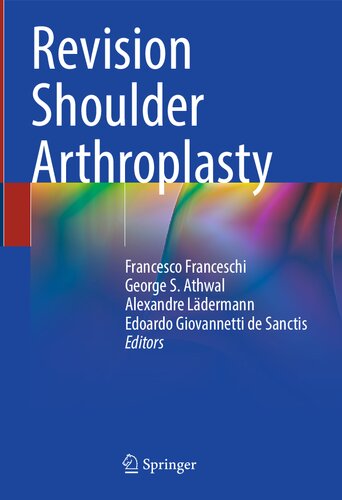 Revision Shoulder Arthroplasty (PDF/EPUB Version)