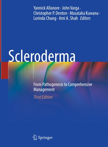 Scleroderma - From Pathogenesis to Comprehensive Management, 3e (Apr 24, 2024)_(3031406575)_(Springer).pdf (PDF/EPUB Version)