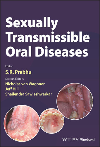 Sexually Transmissible Oral Diseases (PDF/EPUB Version)
