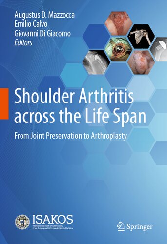 Shoulder Arthritis across the Life Span: From Joint Preservation to Arthroplasty (PDF/EPUB Version)
