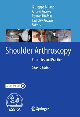 Shoulder Arthroscopy: Principles and Practice (PDF/EPUB Version)
