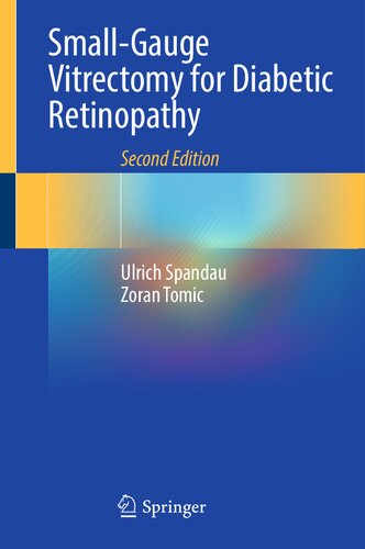 Small-Gauge Vitrectomy for Diabetic Retinopathy (PDF/EPUB Version)
