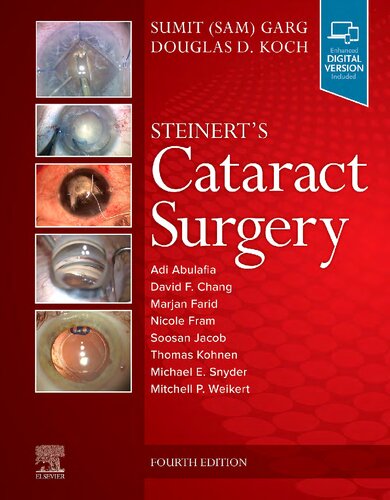 Steinert's Cataract Surgery (PDF/EPUB Version)
