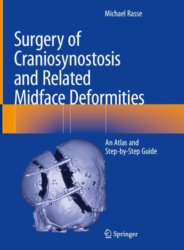Surgery of Craniosynostosis and Related Midface Deformities: An Atlas and Step-by-Step Guide (PDF/EPUB Version)