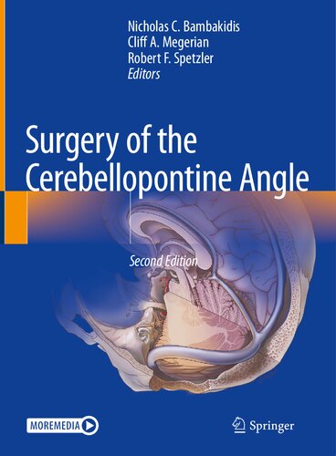 Surgery of the Cerebellopontine Angle (PDF/EPUB Version)
