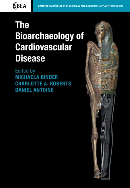 The Bioarchaeology of Cardiovascular Disease (PDF/EPUB Version)
