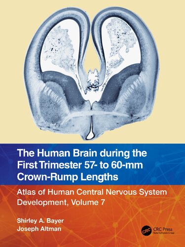The Human Brain during the First Trimester 57- to 60-mm Crown-Rump Lengths (PDF/EPUB Version)
