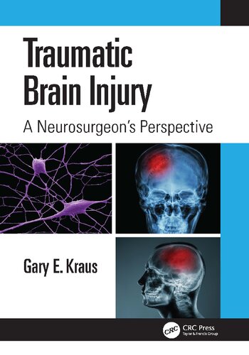 Traumatic Brain Injury: A Neurosurgeon's Perspective (PDF/EPUB Version)

