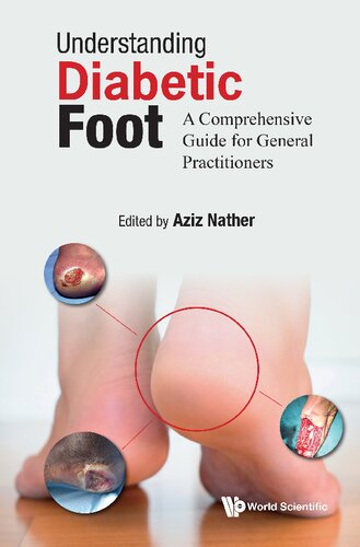 Understanding Diabetic Foot: A Comprehensive Guide For General Practitioners (PDF/EPUB Version)
