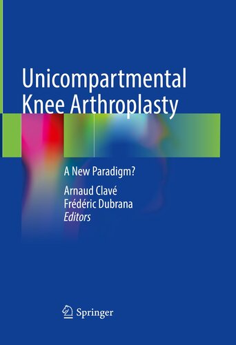 Unicompartmental Knee Arthroplasty: A New Paradigm? (PDF/EPUB Version)