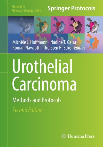 Urothelial Carcinoma: Methods and Protocols (PDF/EPUB Version)
