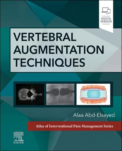 Vertebral Augmentation Techniques (PDF/EPUB Version)
