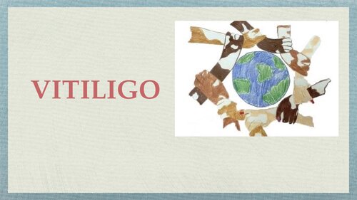Vitiligo (PDF/EPUB Version)