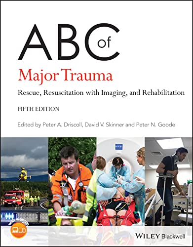 ABC of Major Trauma: Rescue, Resuscitation with Imaging, and Rehabilitation (ABC Series) (PDF/EPUB Version)