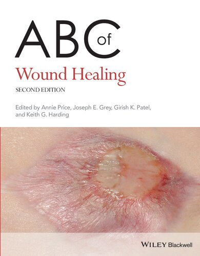 ABC of Wound Healing (ABC Series) (PDF/EPUB Version)