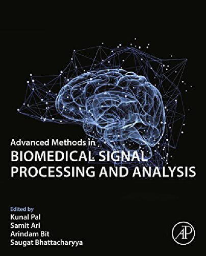 Advanced Methods in Biomedical Signal Processing and Analysis (PDF/EPUB Version)