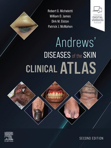 Andrews' Diseases of the Skin Clinical Atlas (PDF/EPUB Version)