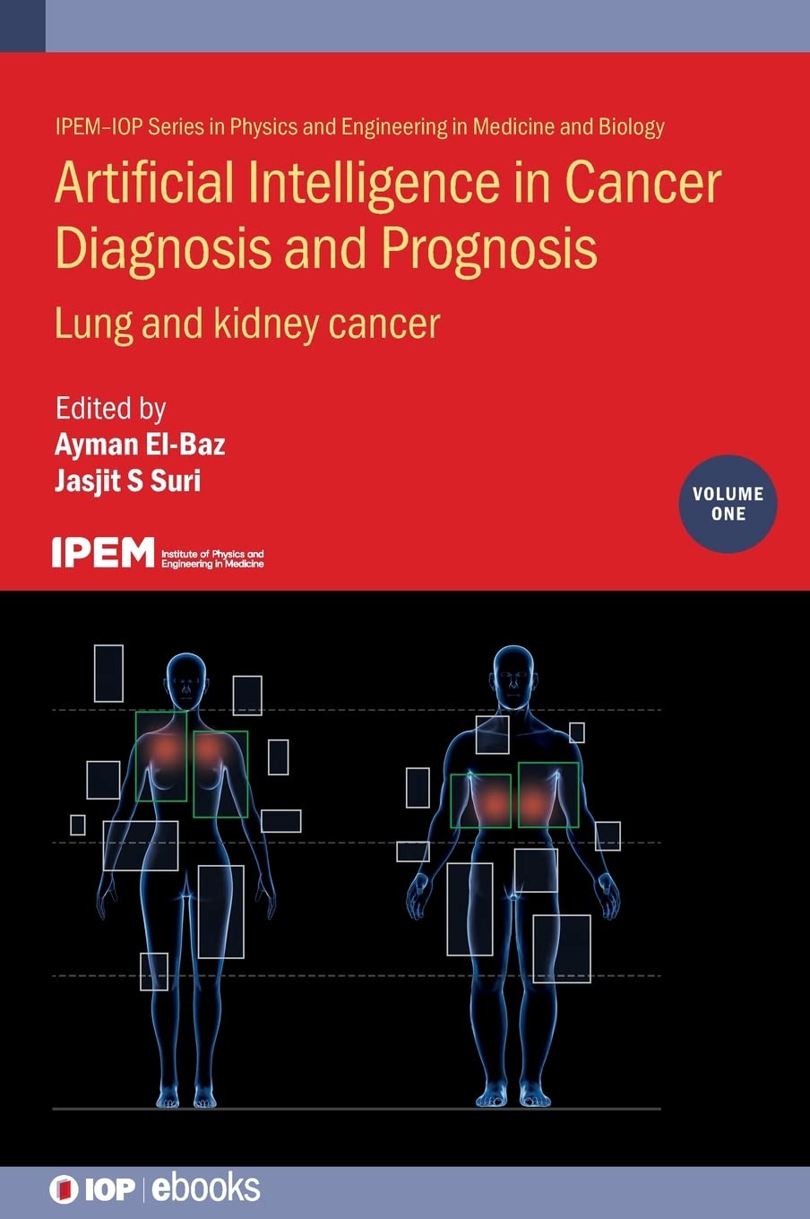 Artificial Intelligence in Cancer Diagnosis and Prognosis, Volume 1: Lung and kidney cancer (PDF/EPUB Version)