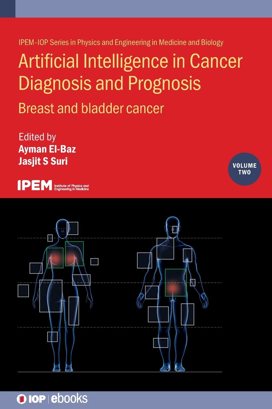 Artificial Intelligence in Cancer Diagnosis and Prognosis, Volume 2: Breast and bladder cancer (PDF/EPUB Version)