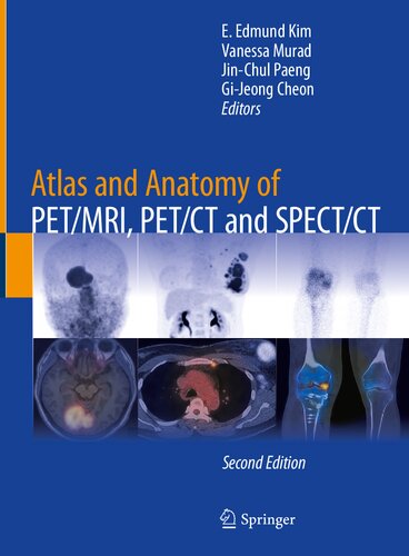 Atlas and Anatomy of PET/MRI, PET/CT and SPECT/CT (PDF/EPUB Version)