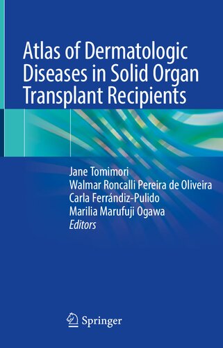 Atlas of Dermatologic Diseases in Solid Organ Transplant Recipients (PDF/EPUB Version)