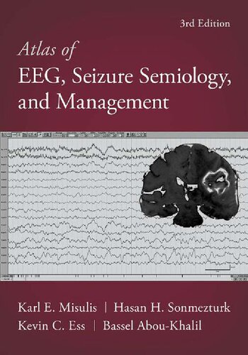 Atlas of EEG, Seizure Semiology, and Management [Team-IRA] (True PDF) (PDF/EPUB Version)