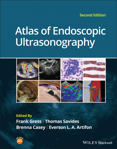 Atlas of Endoscopic Ultrasonography (PDF/EPUB Version)