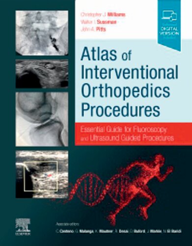Atlas of Interventional Orthopedics Procedures: Essential Guide for Fluoroscopy and Ultrasound Guided Procedures (PDF/EPUB Version)