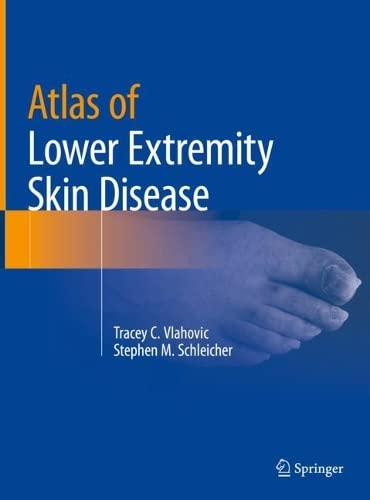Atlas of Lower Extremity Skin Disease (PDF/EPUB Version)