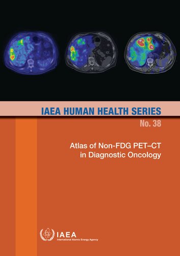 Atlas of Non-FDG PET–CT in Diagnostic Oncology (PDF/EPUB Version)