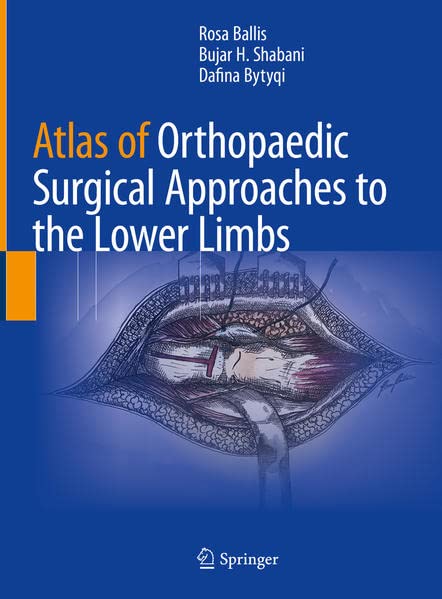 Atlas of Orthopaedic Surgical Approaches to the Lower Limbs (PDF/EPUB Version)